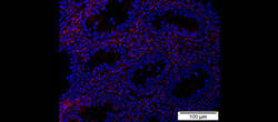 Das Protein Bcl-3 (rot) führt zu chronischen Entzündungen im Darm. © Universitätsmedizin Mainz