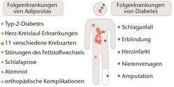 Mögliche Folgeerkrankungen von Adipositas und Diabetes mellitus. © UZV